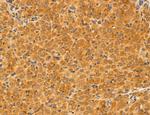ACSL4 Antibody in Immunohistochemistry (Paraffin) (IHC (P))