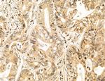 AGTPBP1 Polyclonal Antibody