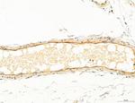 Clathrin Light Chain Polyclonal Antibody
