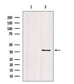 Clathrin Light Chain Antibody in Western Blot (WB)