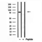 Coilin Antibody in Western Blot (WB)