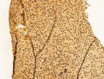 YTHDF2 Antibody in Immunohistochemistry (Paraffin) (IHC (P))