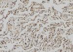 ZCCHC11 Antibody in Immunohistochemistry (Paraffin) (IHC (P))