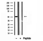 SLC30A6 Antibody in Western Blot (WB)