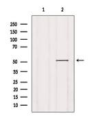 SLC30A6 Polyclonal Antibody