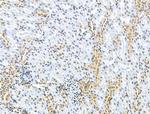 CKAP4 Antibody in Immunohistochemistry (Paraffin) (IHC (P))