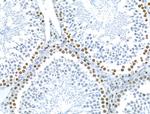 CKAP4 Antibody in Immunohistochemistry (Paraffin) (IHC (P))