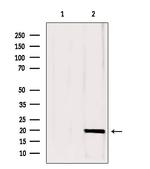 CPLX1 Polyclonal Antibody