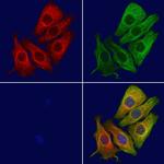 CYP26B1 Polyclonal Antibody