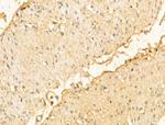 DPT Polyclonal Antibody