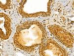Importin 4 Antibody in Immunohistochemistry (Paraffin) (IHC (P))