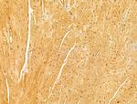 MAVS Antibody in Immunohistochemistry (Paraffin) (IHC (P))