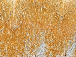 PKLR Antibody in Immunohistochemistry (Paraffin) (IHC (P))