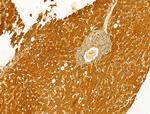 PKLR Antibody in Immunohistochemistry (Paraffin) (IHC (P))