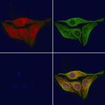 PKLR Polyclonal Antibody