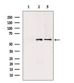 PKLR Antibody in Western Blot (WB)
