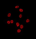 SRP68 Antibody in Immunocytochemistry (ICC/IF)