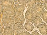 SRP68 Antibody in Immunohistochemistry (Paraffin) (IHC (P))