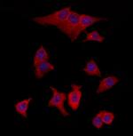 TMOD4 Polyclonal Antibody