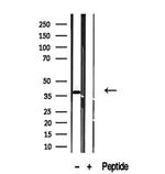 TMOD4 Antibody in Western Blot (WB)