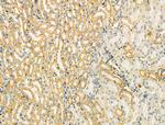TOMM40 Antibody in Immunohistochemistry (Paraffin) (IHC (P))