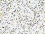 TOMM40 Antibody in Immunohistochemistry (Paraffin) (IHC (P))