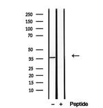 TOMM40 Antibody in Western Blot (WB)