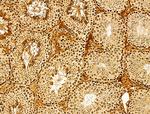 AEBP2 Antibody in Immunohistochemistry (Paraffin) (IHC (P))