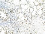 AEBP2 Antibody in Immunohistochemistry (Paraffin) (IHC (P))