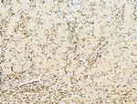 AEBP2 Antibody in Immunohistochemistry (Paraffin) (IHC (P))