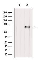 ASAH1 Polyclonal Antibody