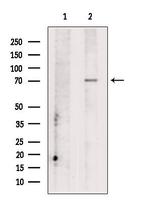 CCDC22 Polyclonal Antibody