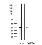 CHCHD6 Antibody in Western Blot (WB)