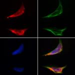 CMIP Polyclonal Antibody