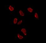 CMIP Antibody in Immunocytochemistry (ICC/IF)