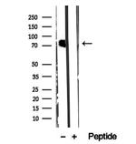 CMIP Antibody in Western Blot (WB)