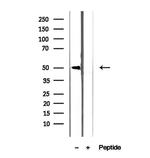 CREST Antibody in Western Blot (WB)