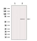 DBR1 Antibody in Western Blot (WB)