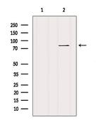 HDGFRP2 Antibody in Western Blot (WB)