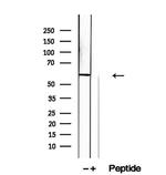 KIF12 Antibody in Western Blot (WB)