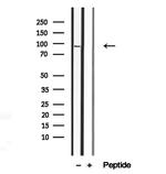 MAGOH Antibody in Western Blot (WB)