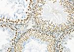 SFPQ Antibody in Immunohistochemistry (Paraffin) (IHC (P))