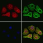 SMOX Polyclonal Antibody