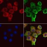 SRP14 Polyclonal Antibody