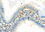 SULT1C2 Polyclonal Antibody