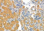 SULT1C2 Antibody in Immunohistochemistry (Paraffin) (IHC (P))