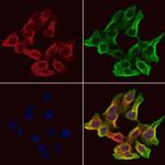 TRIM9 Polyclonal Antibody