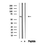 TRIM9 Antibody in Western Blot (WB)