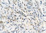 D4-GDI Antibody in Immunohistochemistry (Paraffin) (IHC (P))