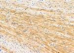 ARL8B Antibody in Immunohistochemistry (Paraffin) (IHC (P))